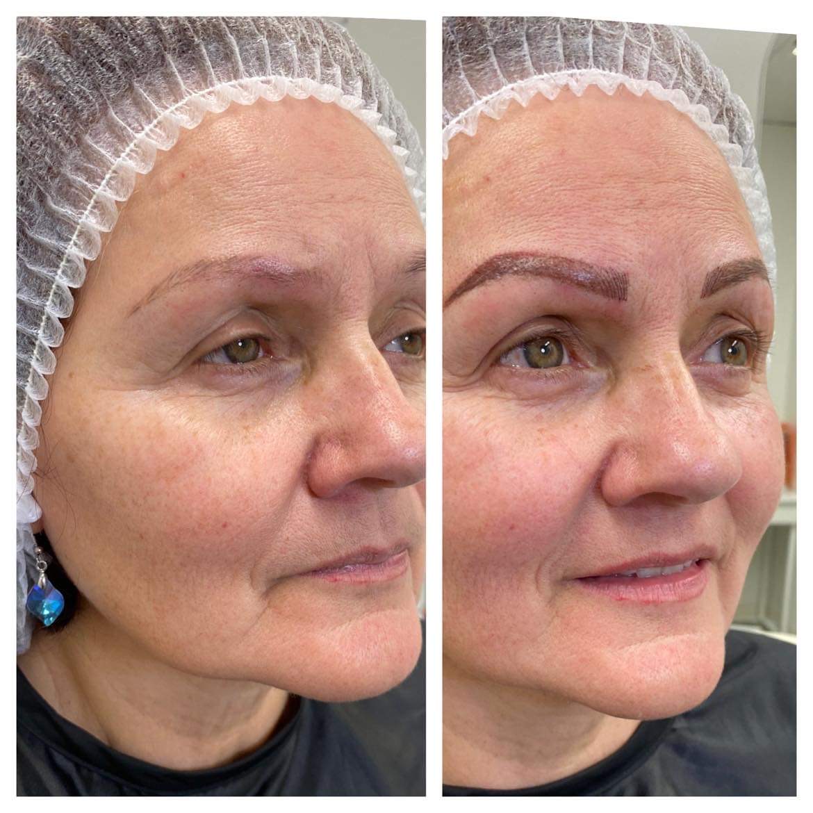 A woman with a plastic bag on her head and a before and after photo of the same person.