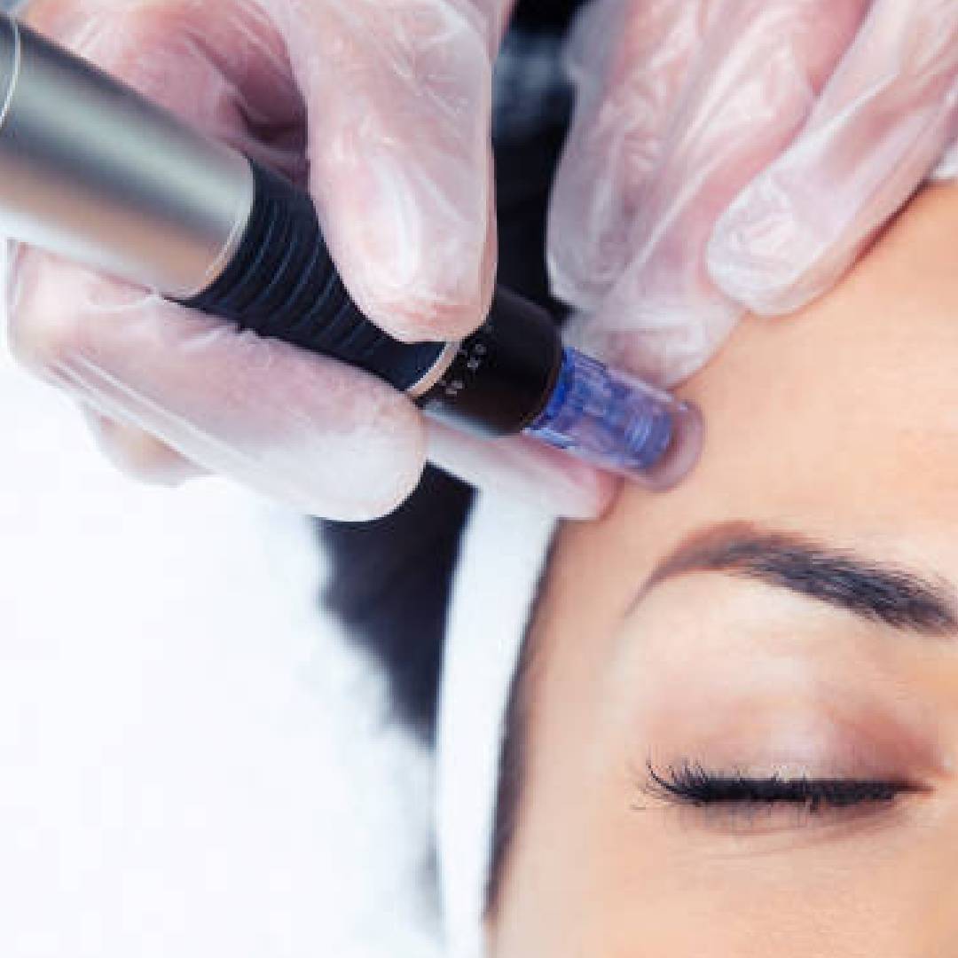 A person getting their eyebrows done with an electric device.