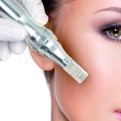 Microneedling