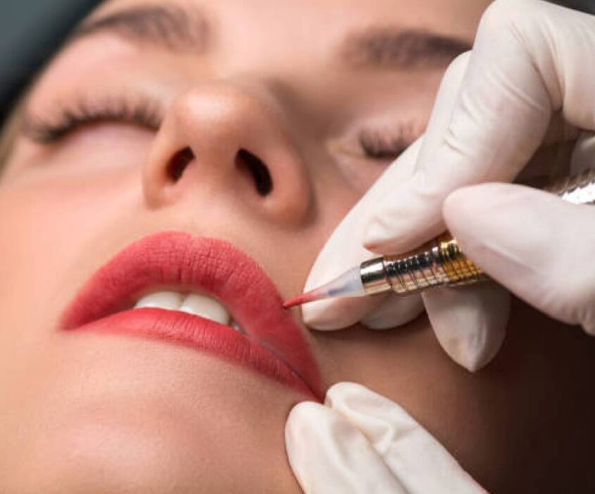 A woman getting an injected into her lips.